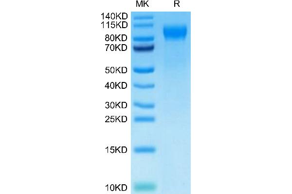 Selectin E/CD62e Protein (AA 22-554) (His tag)