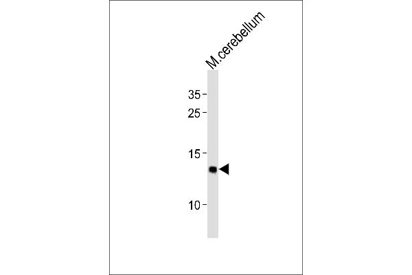 EIF1 Antikörper  (C-Term)