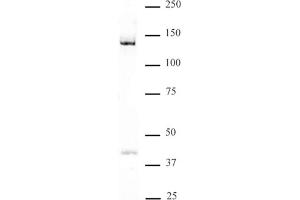 DDB1 antibody (pAb) tested by Western blot Nuclear extract of HeLa cells (30 μg) probed with DDB1 antibody (1:500). (DDB1 Antikörper  (C-Term))
