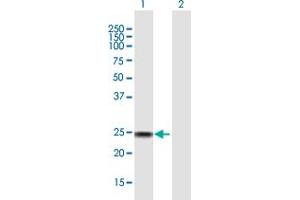 Western Blot analysis of SSX4 expression in transfected 293T cell line by SSX4 MaxPab polyclonal antibody. (SSX4 Antikörper  (AA 1-188))