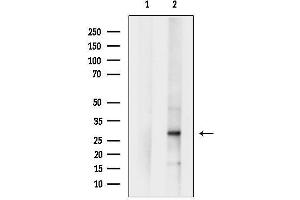 anti-Chymotrypsin (CTRL) (C-Term) antibody