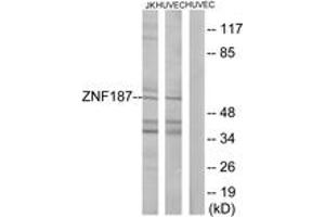 Western Blotting (WB) image for anti-Zinc Finger Protein 187 (ZNF187) (AA 51-100) antibody (ABIN2889623) (ZNF187 Antikörper  (AA 51-100))