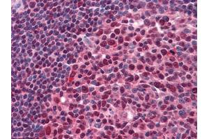 Immunohistochemistry (IHC) image for anti-Ring Finger and CHY Zinc Finger Domain Containing 1, E3 Ubiquitin Protein Ligase (RCHY1) antibody (ABIN1724723)