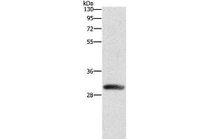 Western Blot analysis of Mouse heart tissue using DCK Polyclonal Antibody at dilution of 1:550 (DCK Antikörper)