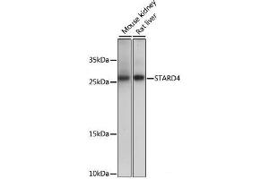 Western blot analysis of extracts of various cell lines using STARD4 Polyclonal Antibody at dilution of 1:1000. (STARD4 Antikörper)