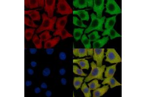 FGFR3 Mouse Monoclonal Antibody staining HepG2 cells by IF/ICC. (FGFR3 Antikörper  (C-Term))