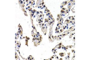 Immunohistochemistry (IHC) image for anti-C-Fos Induced Growth Factor (Vascular Endothelial Growth Factor D) (Figf) (AA 20-220) antibody (ABIN3021686) (VEGFD Antikörper  (AA 20-220))