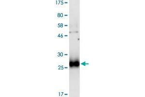 Image no. 2 for Tumor Necrosis Factor Receptor Superfamily, Member 10b (TNFRSF10B) (AA 56-210) protein (His-DYKDDDDK-Strep II Tag) (ABIN1323142) (TNFRSF10B Protein (AA 56-210) (His-DYKDDDDK-Strep II Tag))