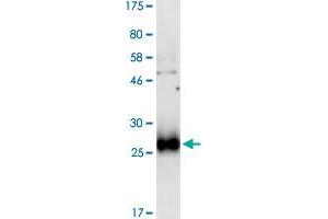 Image no. 2 for Tumor Necrosis Factor Receptor Superfamily, Member 10b (TNFRSF10B) (AA 56-210) protein (His-DYKDDDDK-Strep II Tag) (ABIN1323142)
