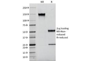 SDS-PAGE Analysis of Purified, BSA-Free Kappa Light Chain Antibody (clone L1C1). (Maus anti-Human kappa Light Chain Antikörper)