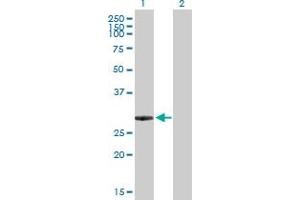 ING5 anticorps  (AA 1-240)