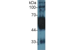 Western Blot; Sample: Rat Tongue lysate; Primary Ab: 1µg/ml Rabbit Anti-Human KRT5 Antibody Second Ab: 0.
