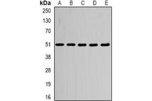 Western blot analysis of Alpha-tubulin 4a expression in HepG2 (A), MCF7 (B), mouse heart (C), mouse brain (D), PC12 (E) whole cell lysates. (TUBA4A Antikörper)