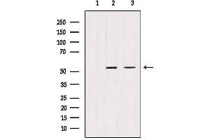 Western blot analysis of extracts from various samples, using TRIM44 antibody.