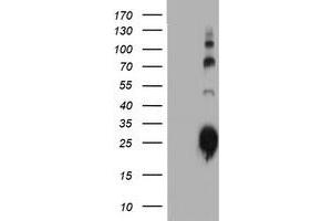 Western Blotting (WB) image for anti-Immunoglobulin J Polypeptide, Linker Protein For Immunoglobulin alpha and mu Polypeptides (IGJ) antibody (ABIN1498838) (IGJ Antikörper)