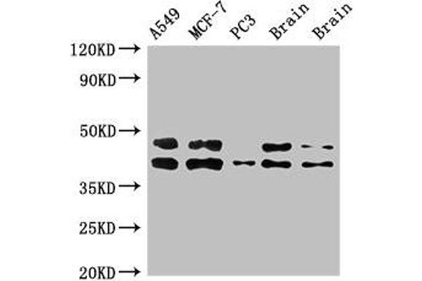 PRKACB Antikörper  (Catalytic Subunit beta)