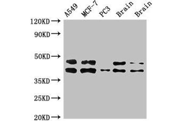 PRKACB antibody  (Catalytic Subunit beta)