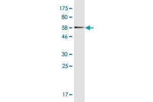 Western Blot detection against Immunogen (54. (MYOZ2 Antikörper  (AA 1-264))