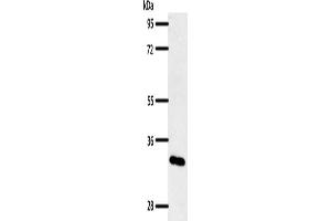 Gel: 10 % SDS-PAGE, Lysate: 50 μg, Lane: Mouse pancreas tissue, Primary antibody: ABIN7192464(SLC2A4RG Antibody) at dilution 1/400, Secondary antibody: Goat anti rabbit IgG at 1/8000 dilution, Exposure time: 1 minute (SLC2A4RG Antikörper)