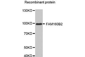 Western blot analysis of extracts of recombinant protein, using FAM160B2 antibody. (FAM160B2 Antikörper  (AA 420-520))
