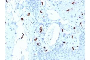 Formalin-fixed, paraffin-embedded human Tonsil stained with Tryptase Mouse Monoclonal Antibody (TPSAB1/1961). (TPSAB1 Antikörper  (AA 115-233))