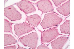 Human Skeletal Muscle: Formalin-Fixed, Paraffin-Embedded (FFPE).
