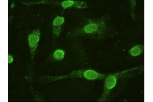 Anti-IL-6 mouse monoclonal antibody (ABIN2452371) immunofluorescent staining of HeLa cells transiently transfected by pCMV6-ENTRY IL-6 (RC202078)
