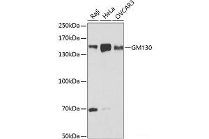Western blot analysis of extracts of various cell lines using GM130 Polyclonal Antibody at dilution of 1:1000. (Golgin A2 (GOLGA2) Antikörper)