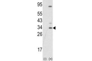Western blot analysis of SNAI1 antibody and 293 cell lysate (2 ug/lane) either nontransfected (Lane 1) or transiently transfected with the SNAIL gene (2). (SNAIL Antikörper  (AA 1-30))