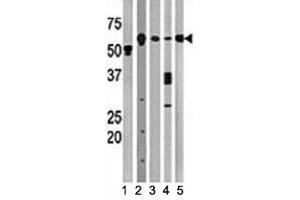Western Blotting (WB) image for anti-Beclin 1, Autophagy Related (BECN1) (AA 210-239) antibody (ABIN3030156)