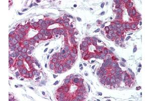 Image no. 1 for anti-Tumor Necrosis Factor (Ligand) Superfamily, Member 11 (TNFSF11) antibody (ABIN302887) (RANKL Antikörper)