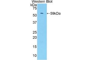 Western blot analysis of the recombinant protein. (IRF1 Antikörper  (AA 44-319))