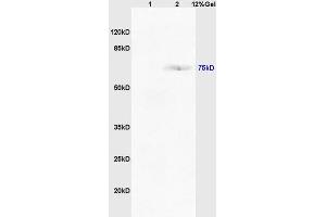 Lane 1: mouse intestine lysates Lane 2: mouse lung lysates probed with Anti TAP2/ABCB3 Polyclonal Antibody, Unconjugated (ABIN680123) at 1:200 in 4 °C. (TAP2 Antikörper  (AA 451-550))
