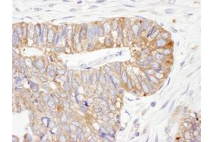 Immunohistochemistry (IHC) image for anti-Protein Disulfide Isomerase Family A, Member 6 (PDIA6) (AA 250-300) antibody (ABIN7453940)