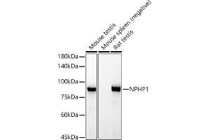 Western blot analysis of extracts of various cell lines, using NPHP1 antibody (ABIN7268847) at 1:1000 dilution. (NPHP1 Antikörper)
