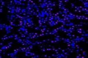 Immunofluorescent analysis of paraformaldehyde-fixed rat kidney using,UCKL1 (ABIN7076157) at dilution of 1: 4000 (UCKL1 Antikörper)