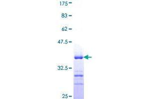 FBLIM1 Protein (AA 270-373) (GST tag)