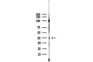 anti-G Protein-Coupled Receptor 82 (GPR82) (C-Term) antibody
