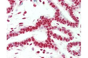 Anti-SMC1A / SMC1 antibody IHC staining of human breast. (SMC1A Antikörper  (C-Term))