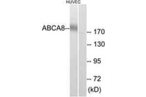 Western blot analysis of extracts from HuvEc cells, using ABCA8 Antibody.