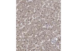 Immunohistochemical analysis of C on paraffin-embedded Human liver tissue. (Cyclin Y Antikörper  (AA 140-169))