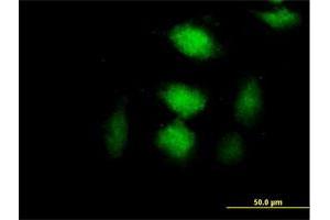 Immunofluorescence of purified MaxPab antibody to CLIC3 on HeLa cell. (CLIC3 Antikörper  (AA 1-236))