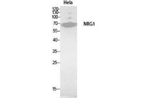Western Blot (WB) analysis of HeLa, HBE cells using Neuregulin-1 Polyclonal Antibody. (Neuregulin 1 Antikörper  (Internal Region))