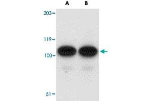 Western blot analysis of AFAP1L2 in human liver tissue lysate with AFAP1L2 polyclonal antibody  at (A) 1 and (B) 2 ug/mL .