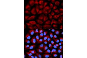 Immunofluorescence analysis of U2OS cells using FANCC antibody.