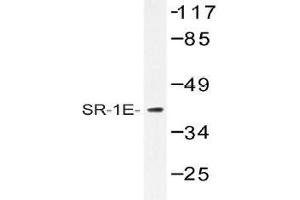 Western blot (WB) analysis of SR-1E antibody in extracts from HeLa cells. (Serotonin Receptor 1E Antikörper)
