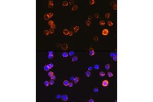 Immunofluorescence analysis of Jurkat cells using CD3E Antigen antibody (ABIN6134272, ABIN6138181, ABIN6138184 and ABIN6216032) at dilution of 1:100. (CD3 epsilon Antikörper  (C-Term))