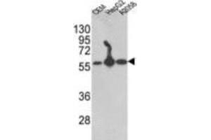 Western Blotting (WB) image for anti-Prolyl 4-Hydroxylase, beta Polypeptide (P4HB) antibody (ABIN3001707) (P4HB Antikörper)