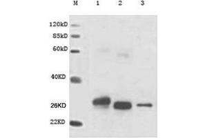 Lane M: MarkerLane 1: GST-Cart (N-terminal) Lane 2: His-GST-His (internal) Lane 3: cMyc-GST (C-terminal) Primary antibody: 1 µg/mL Anti-GST Monoclonal Antibody (Mouse) (ABIN396865) Secondary antibody: Goat Anti-Mouse IgG (H&L) [HRP] Polyclonal Antibody (ABIN398387, 1: 20,000) (GST Antikörper)