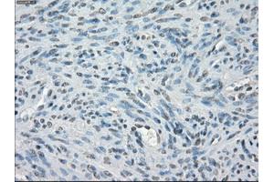 Immunohistochemical staining of paraffin-embedded Ovary tissue using anti-PPP5Cmouse monoclonal antibody. (PP5 Antikörper)